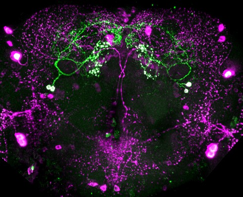 Neurons lit up in the fly brain